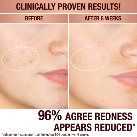 DARK SPOT CORRECTING RADIANCE RECOVERY SERUM 10 ML